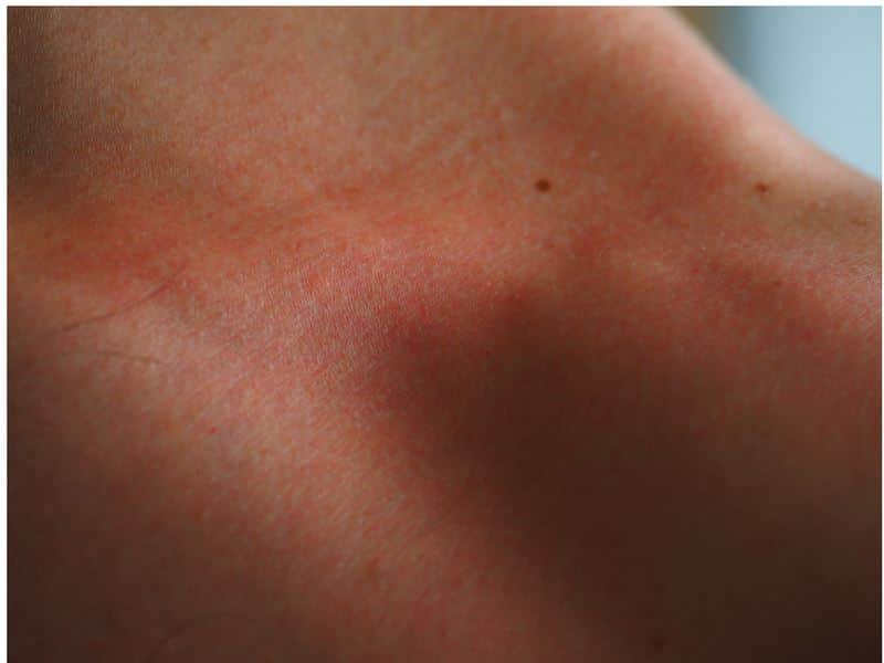 העור ועולם הציפורן