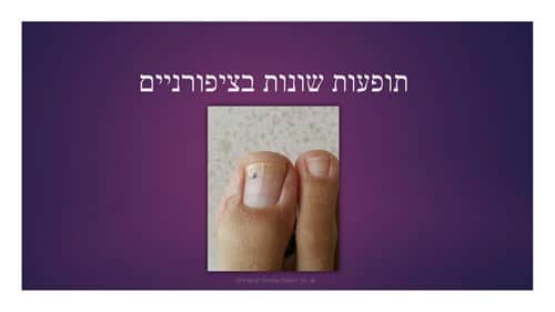 תופעות שונות בציפורניים