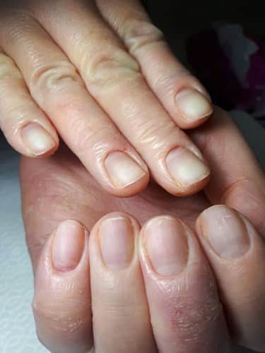 גירויים ואלרגיות